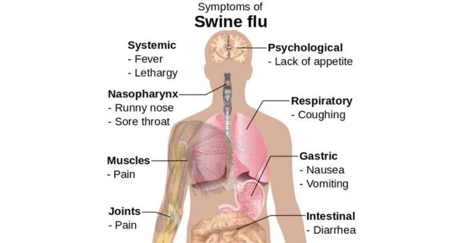 symptoms of swine flu