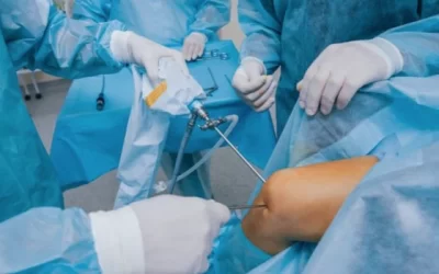 Total Knee Replacement