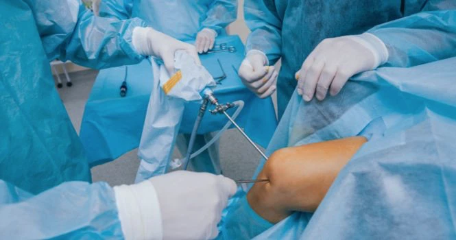 knee surgery