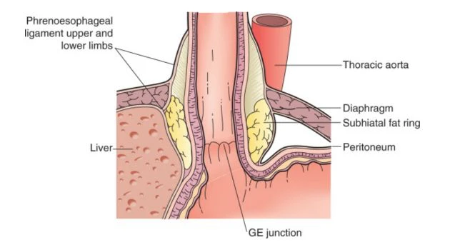 GE Junction