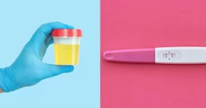 Urine Pregnancy Test