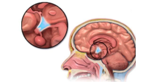 hypothalamus