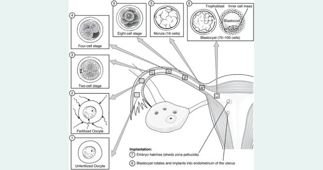 implantation process