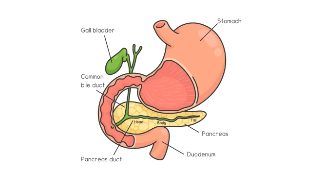 gallbladder stones location