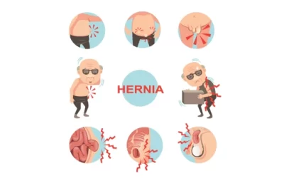 Hernia Surgery Explained: Types, Causes, Symptoms, and Modern Treatment Options